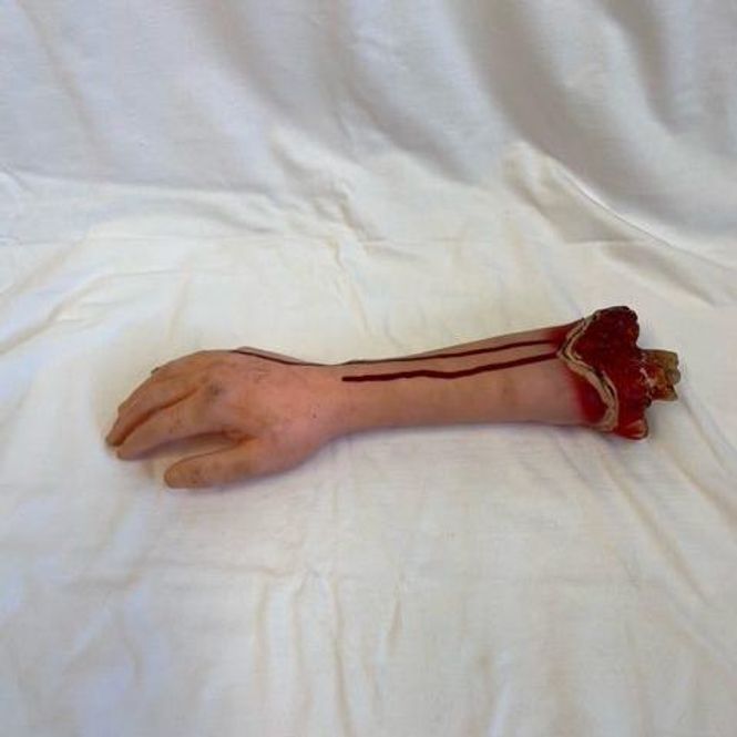 Hovedbilde Avkappet arm